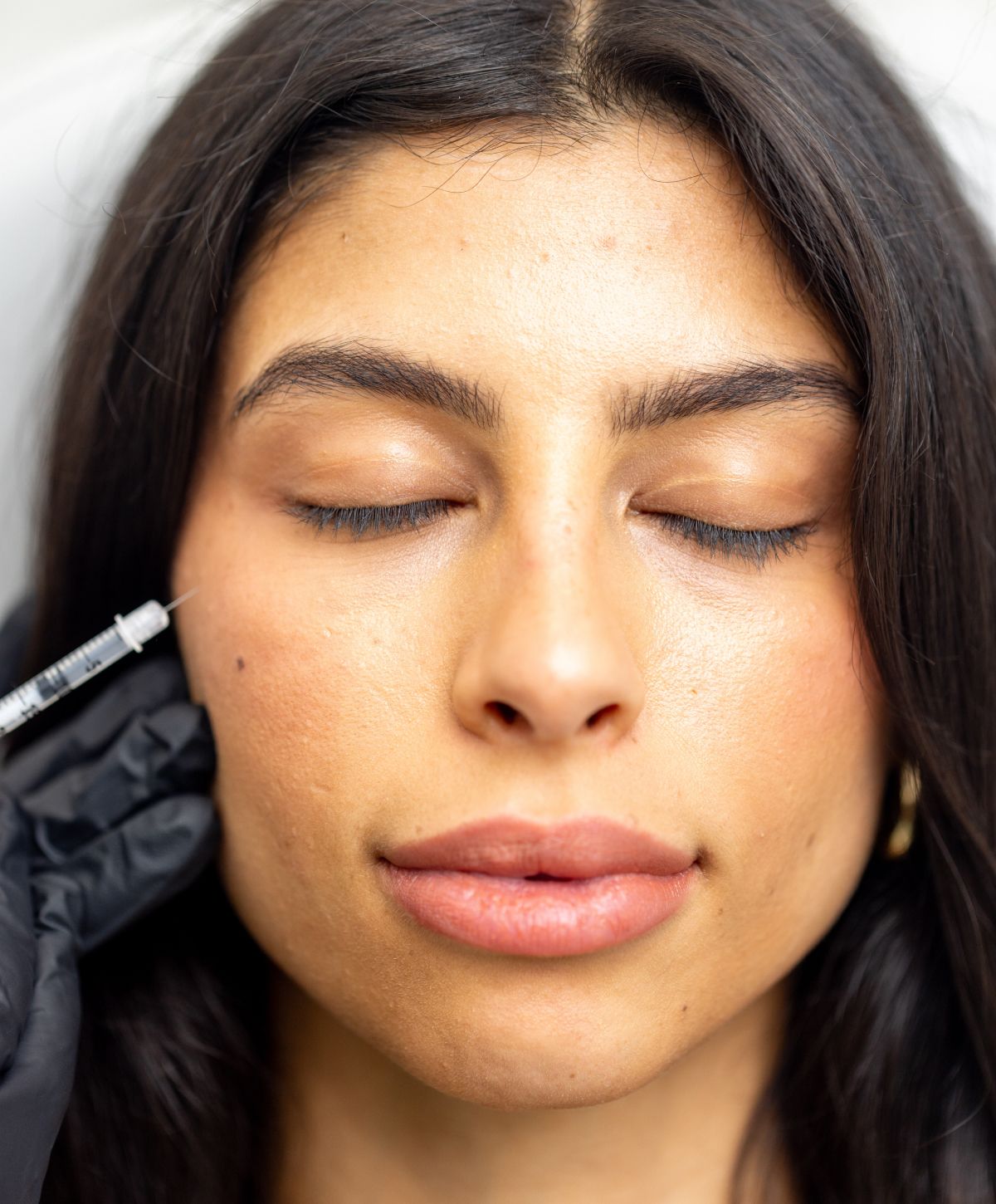 Man receiving cosmetic injection treatment.