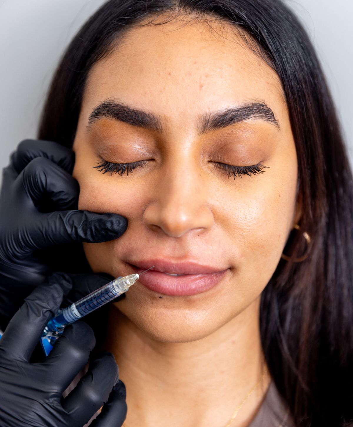 Lip treatment with needle in progress.